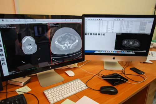 Якутску остро нужны онкокабинеты